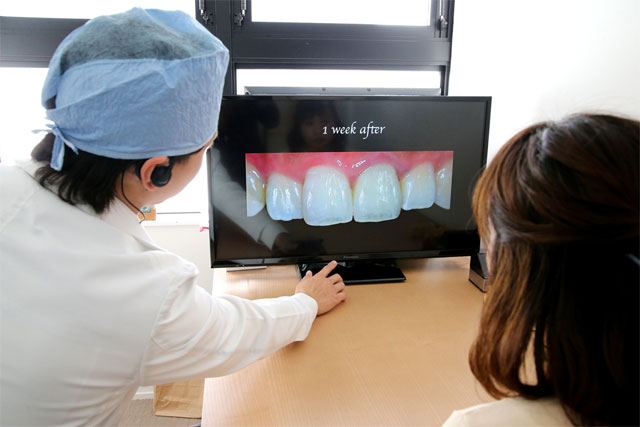 阿倍野、天王寺の歯医者、佐々木歯科の審美歯科イメージ1b