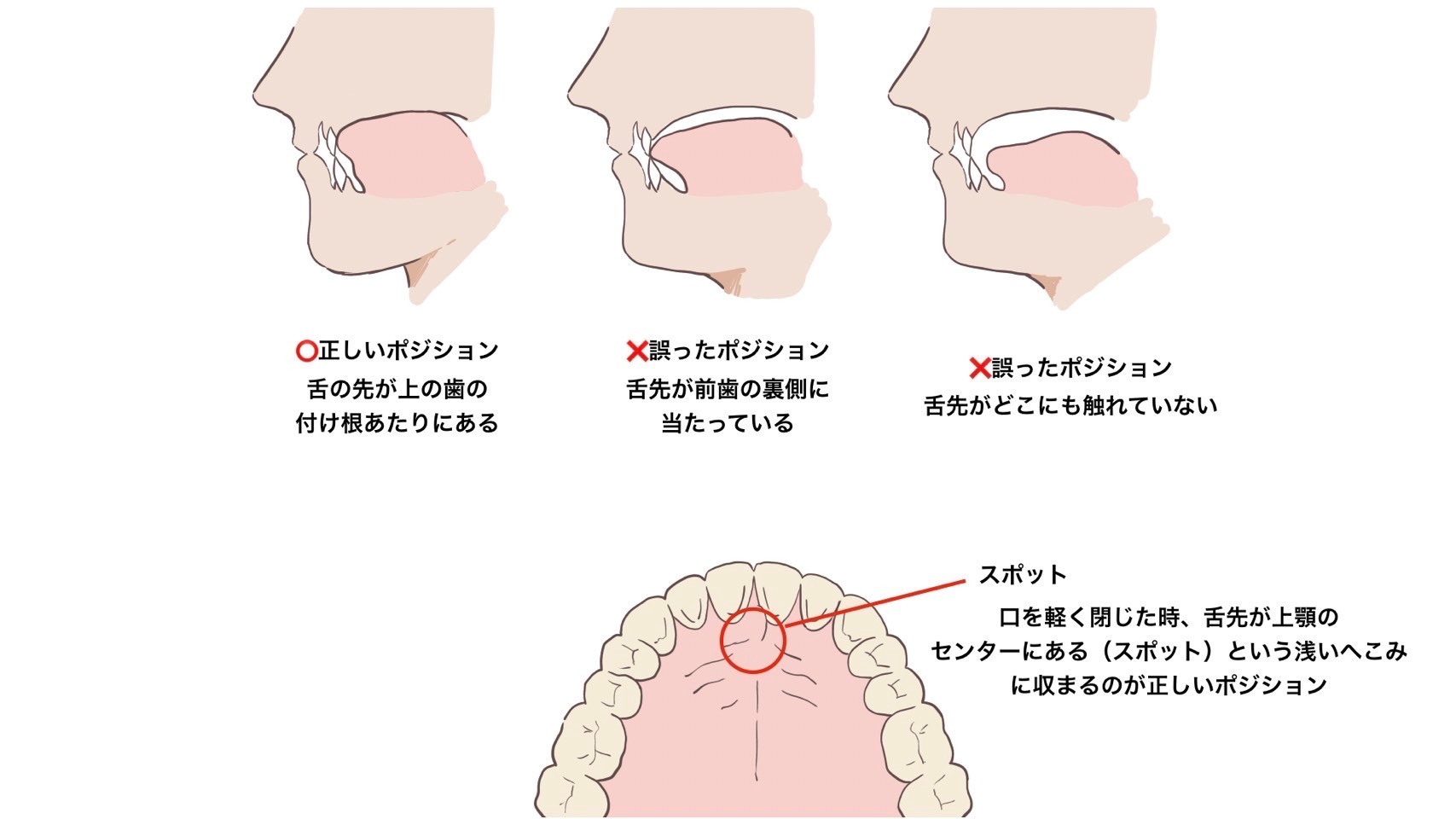 口呼吸は認知症のリスクを高める⁉️ 阿倍野区の(医)佐々木歯科医院