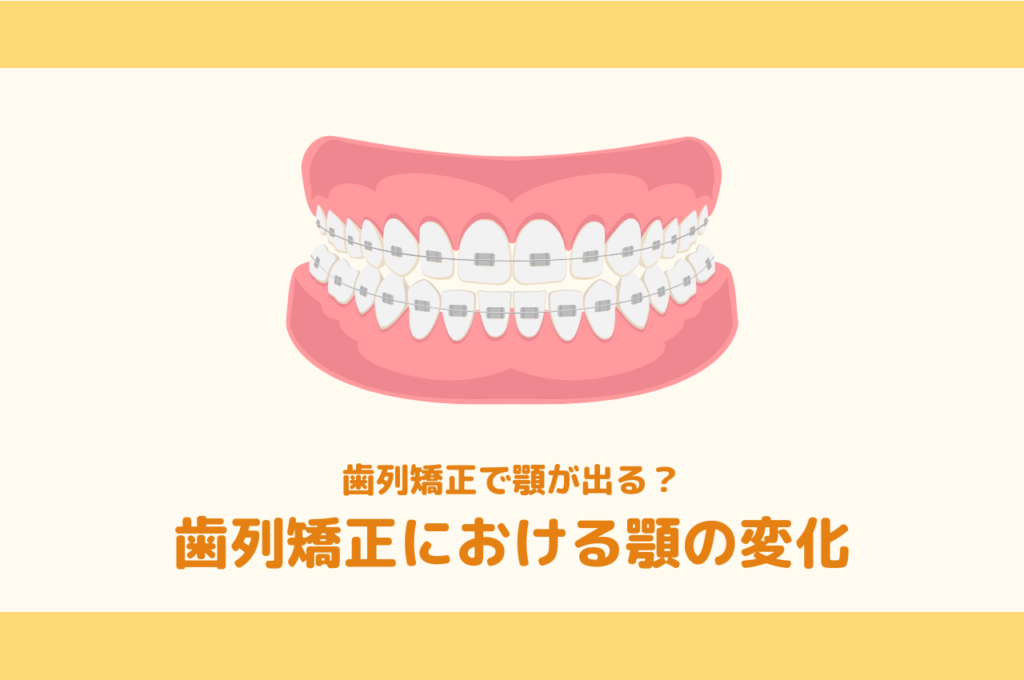 歯列矯正で顎が出る😳?歯列矯正における顎の変化 阿倍野区の(医)佐々木歯科医院^ ^