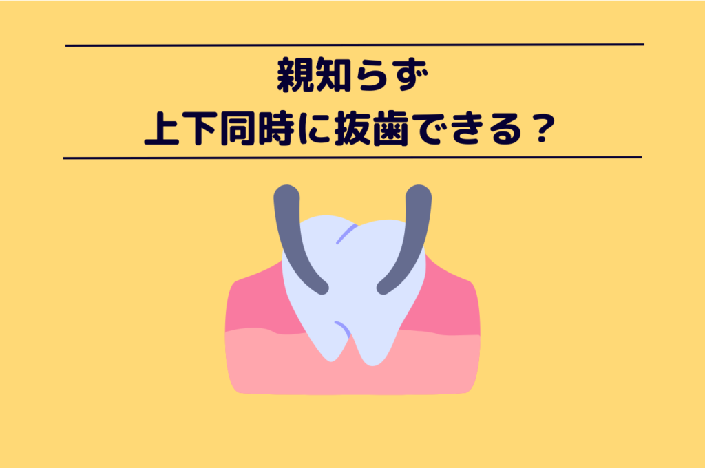 親知らずは上下同時に抜歯できる? 阿倍野区の(医)佐々木歯科医院^ ^