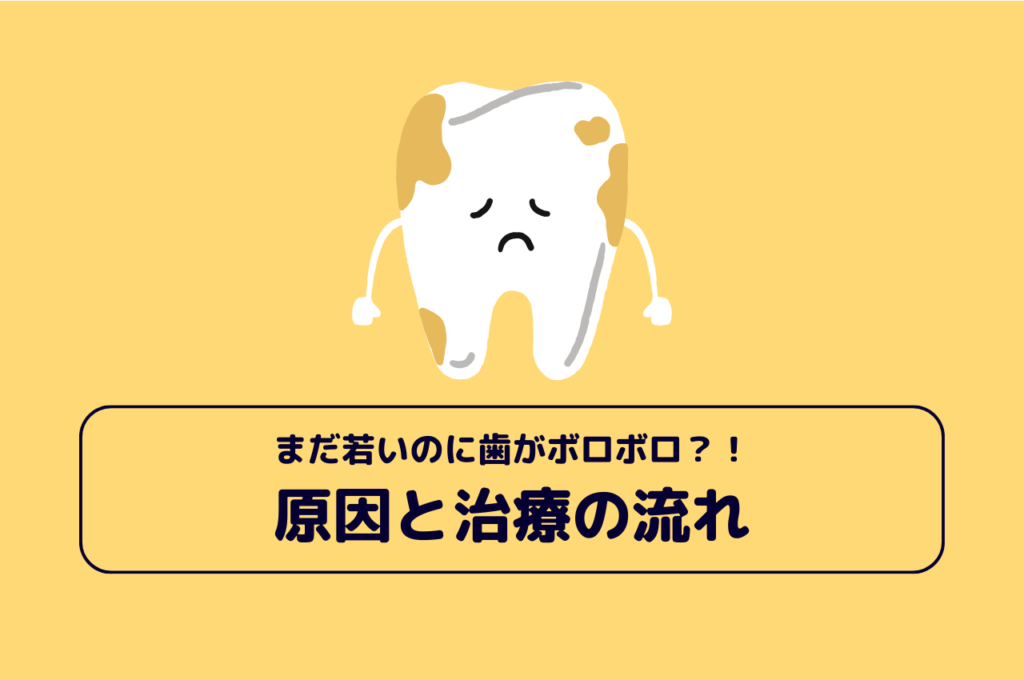 まだ若いのに歯がボロボロ?!原因と治療の流れ 阿倍野区の(医)佐々木歯科医院^ ^