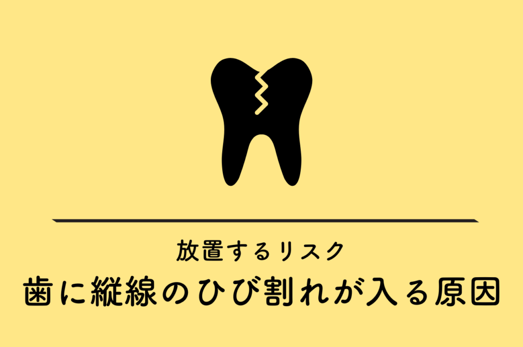 歯に縦線のひび割れが入る原因とは?放置するリスクについても解説します! 阿倍野区の(医)佐々木歯科医院^ ^