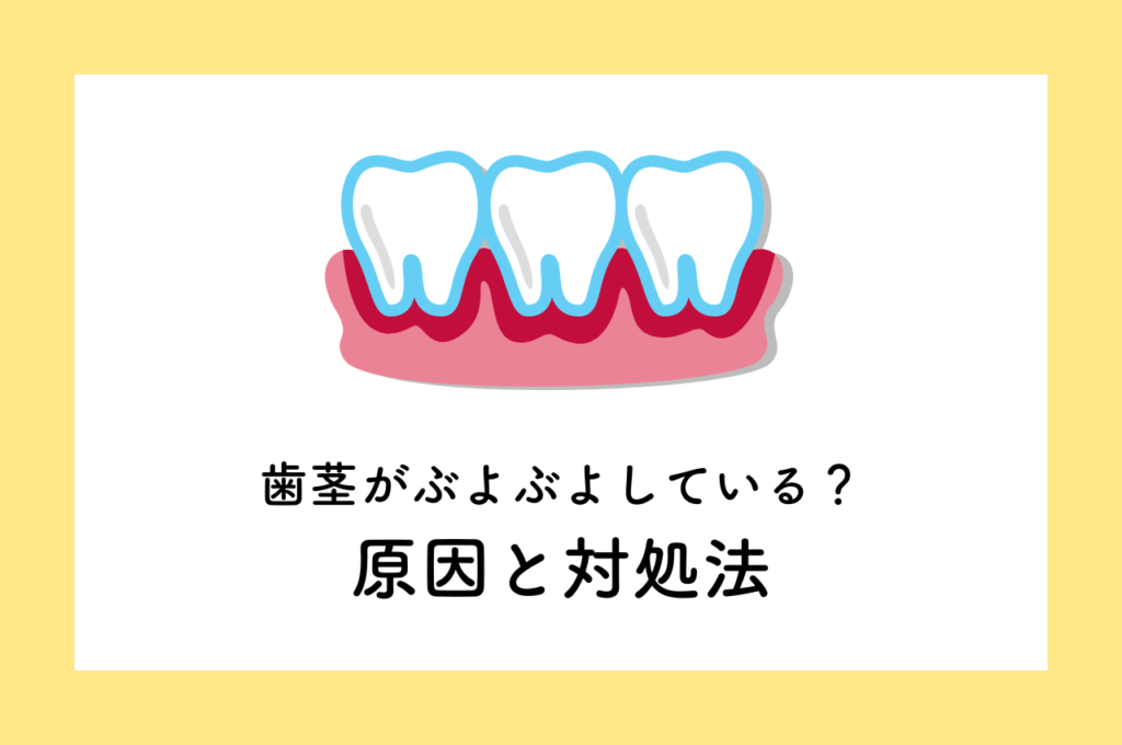 痛くないけど歯茎がぶよぶよしている!原因と対処法についてお話します! 阿倍野区の(医)佐々木歯科医院^ ^