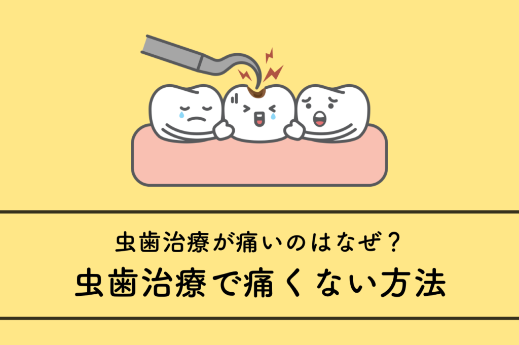 虫歯治療が痛いのはなぜ?虫歯治療で痛くない方法をご紹介します! 阿倍野区の(医)佐々木歯科医院^ ^