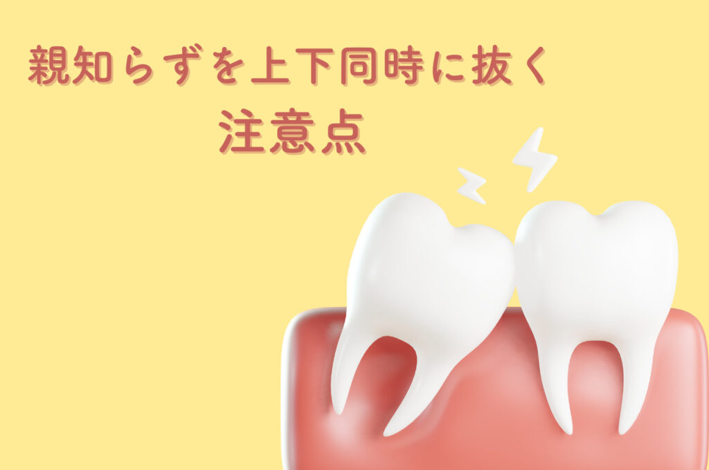 親知らずを上下同時に抜く場合の注意点について解説!阿倍野区の(医)佐々木歯科医院^ ^