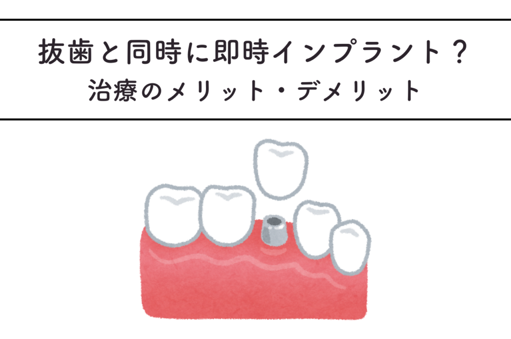 抜歯と同時にインプラント?即時インプラント治療のメリット・デメリットを解説 阿倍野区の(医)佐々木歯科医院^ ^