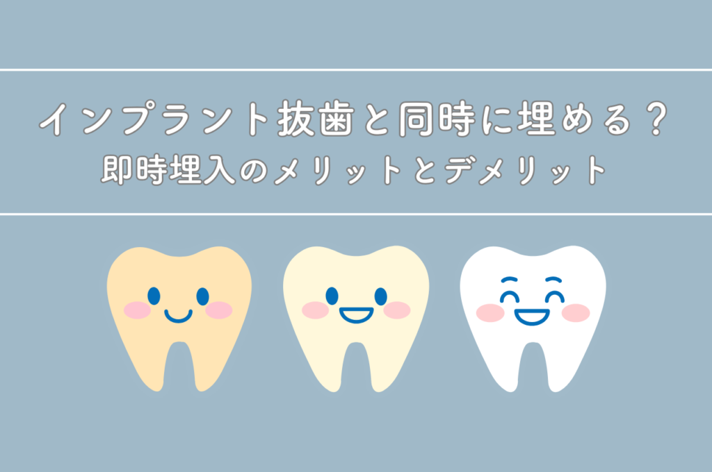 インプラントを抜歯と同時に埋める?即時埋入のメリットとデメリットを解説 阿倍野区の(医)佐々木歯科医院^ ^