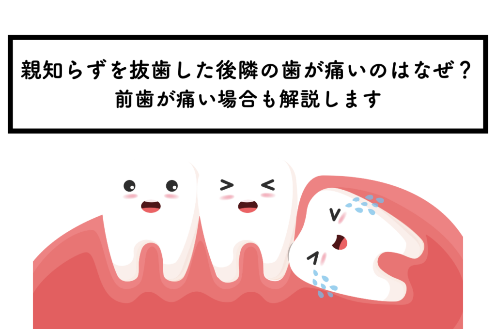親知らずを抜歯した後、隣の歯が痛いのはなぜ?前歯が痛い場合も解説します! 阿倍野区の(医)佐々木歯科医院^ ^