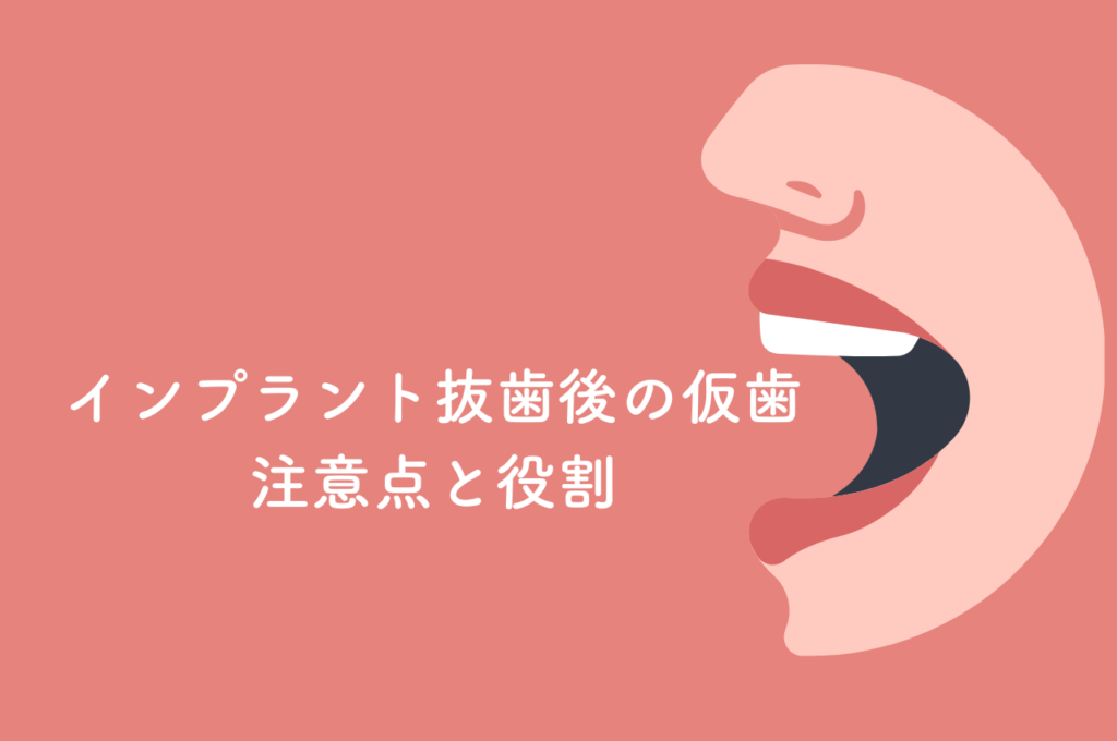 インプラント抜歯後の仮歯について知っておきたい注意点と役割 阿倍野区の(医)佐々木歯科医院^ ^